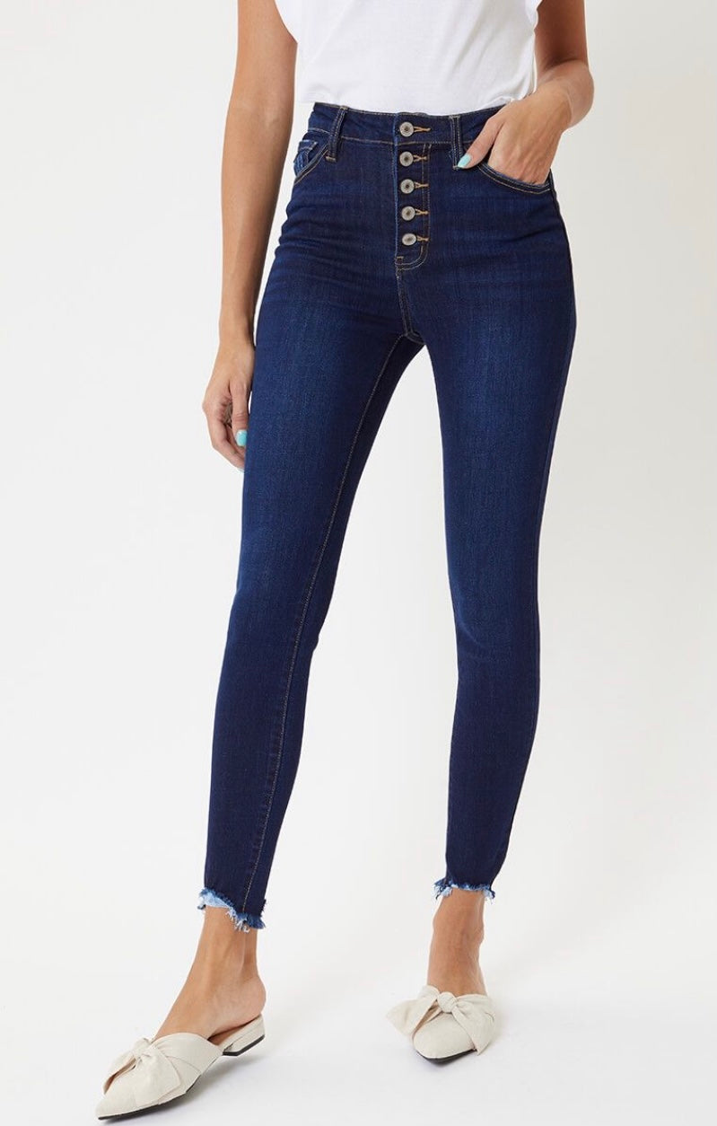 The Willow Skinny Jeans